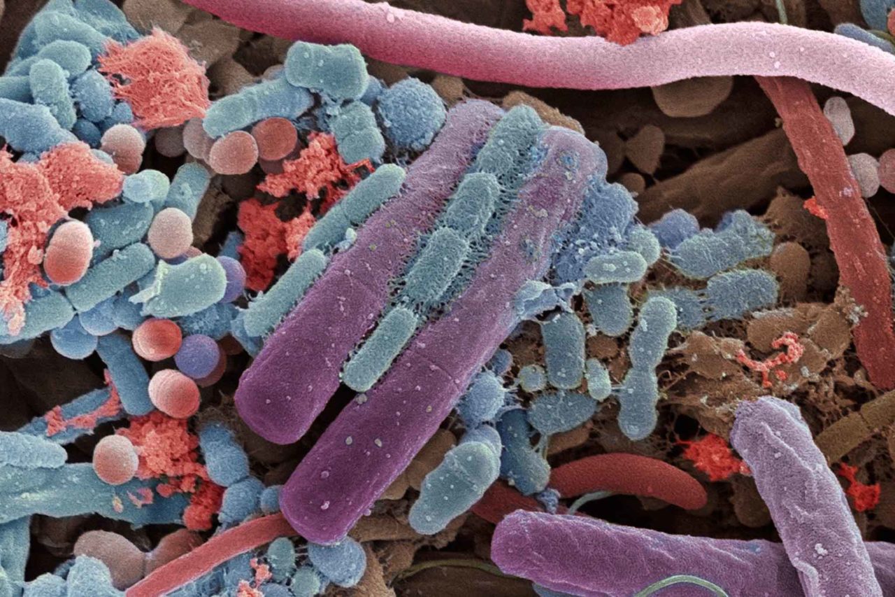 ingrandimento elettronico microbiota